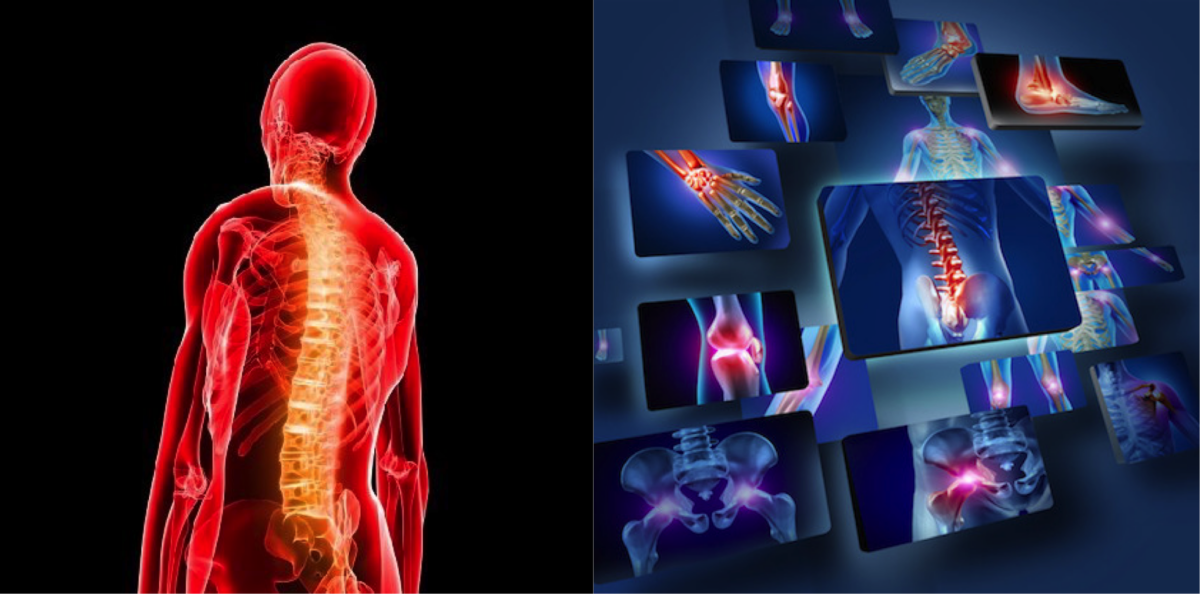 Inflammation and the Immune system